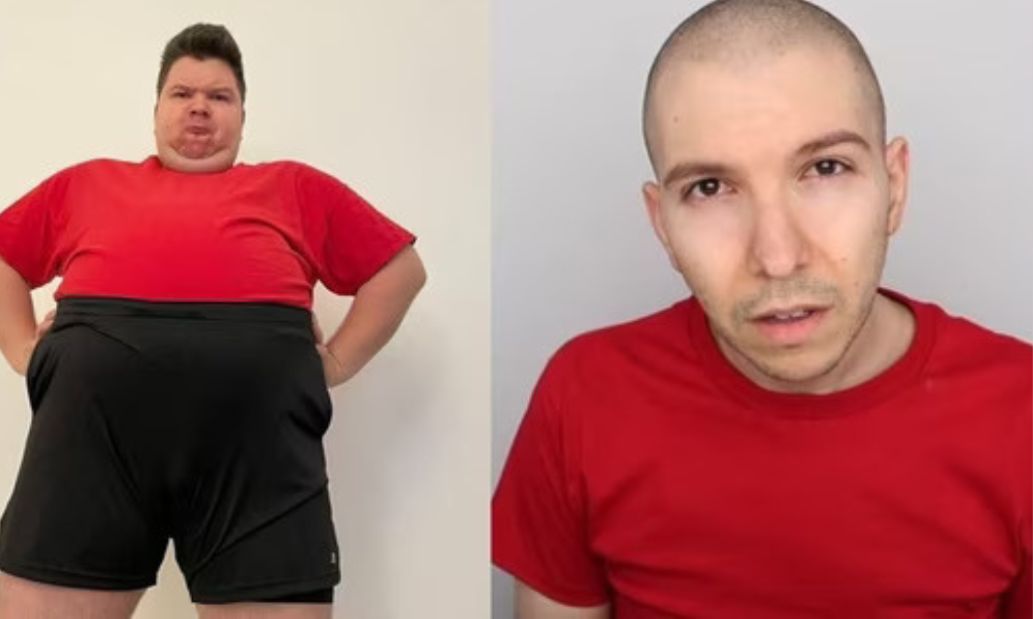 Nikocado Avocado’s Shocking Transformation